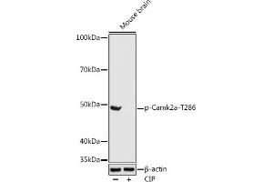 Western blot analysis of extracts of Mouse brain, using Phospho-Camk2a-T286 antibody (ABIN3019946, ABIN3019947, ABIN3019948 and ABIN1681430) at 1:1000 dilution. (CAMK2A 抗体  (pThr286))