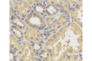 Immunohistochemistry of paraffin-embedded Human kidney using SMYD5 Polyclonal Antibody (SMYD5 抗体)