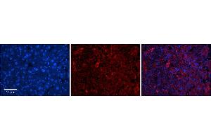 Rabbit Anti-DHX30 Antibody      Formalin Fixed Paraffin Embedded Tissue: Human Adult Liver   Observed Staining: Cytoplasm in hepatocytes, moderate signal, wide tissue distribution  Primary Antibody Concentration: 1:100  Secondary Antibody: Donkey anti-Rabbit-Cy3  Secondary Antibody Concentration: 1:200  Magnification: 20X  Exposure Time: 0. (DHX30 抗体  (N-Term))
