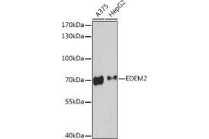 Western blot analysis of extracts of various cell lines, using EDEM2 Rabbit pAb (ABIN7267004) at 1:3000 dilution. (EDEM2 抗体  (AA 399-578))