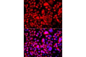 Immunofluorescence analysis of A549 cell using FASN antibody. (Fatty Acid Synthase 抗体)