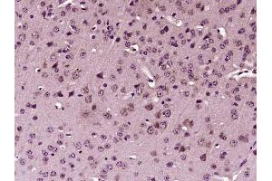 Paraformaldehyde-fixed, paraffin embedded mouse brain, Antigen retrieval by boiling in sodium citrate buffer (pH6) for 15min, Block endogenous peroxidase by 3% hydrogen peroxide for 30 minutes, Blocking buffer (normal goat serum) at 37°C for 20min, Antibody incubation with , Unconjugated  at 1:400 overnight at 4°C, followed by a conjugated secondary and DAB staining.