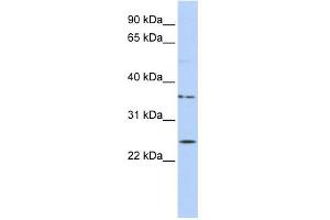 WB Suggested Anti-IQCF1 Antibody Titration: 0. (IQCF1 抗体  (Middle Region))