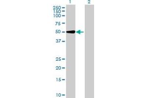 Western Blot analysis of UGT2A3 expression in transfected 293T cell line by UGT2A3 MaxPab polyclonal antibody. (UGT2A3 抗体  (AA 1-527))