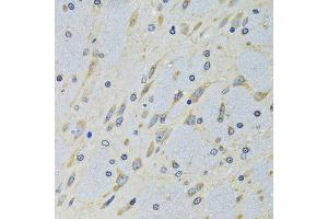 Immunohistochemistry of paraffin-embedded mouse brain using DARS antibody (ABIN5973949) at dilution of 1/100 (40x lens). (DARS 抗体)
