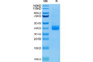 Biotinylated Human NKp46 (Primary Amine Labeling) on Tris-Bis PAGE under reduced condition. (NCR1 Protein (AA 22-254) (His tag,Biotin))