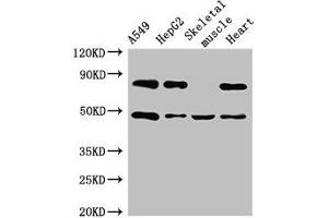 Western Blot Positive WB detected in: A549 whole cell lysate, HepG2 whole cell lysate, Mouse skeletal muscle tissue, Rat heart tissue All lanes: ASB4 antibody at 3 μg/mL Secondary Goat polyclonal to rabbit IgG at 1/50000 dilution Predicted band size: 49, 39 kDa Observed band size: 49 kDa (ASB4 抗体  (AA 166-321))