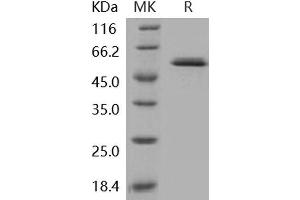 Western Blotting (WB) image for Glucokinase (Hexokinase 4) (GCK) protein (ABIN7317079) (GCK 蛋白)
