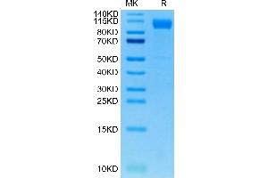 SARS-COV-2 Spike S1 (Deltacron) on Tris-Bis PAGE under reduced condition. (SARS-CoV-2 Spike S1 Protein (Deltacron) (His tag))