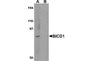 Western Blotting (WB) image for anti-Bicaudal D Homolog 1 (BICD1) (C-Term) antibody (ABIN1030294) (BICD1 抗体  (C-Term))