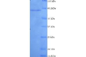 Matrix Metalloproteinase 2 (MMP2) (AA 110-662), (full length) protein (His tag)
