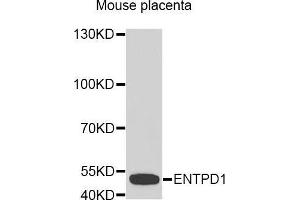Western Blotting (WB) image for anti-Ectonucleoside Triphosphate diphosphohydrolase 1 (ENTPD1) (AA 1-180) antibody (ABIN1679729) (CD39 抗体  (AA 1-180))