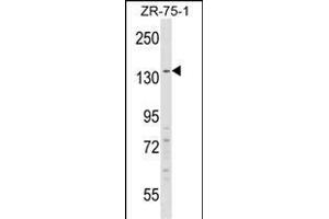 RFX1 Antibody (C-term) (ABIN1537643 and ABIN2848461) western blot analysis in ZR-75-1 cell line lysates (35 μg/lane). (RFX1 抗体  (C-Term))