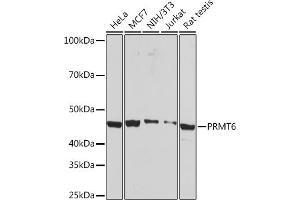 Western blot analysis of extracts of various cell lines, using PRMT6 Rabbit mAb (ABIN7269606) at 1:1000 dilution. (PRMT6 抗体)