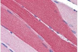 Human Skeletal Muscle: Formalin-Fixed, Paraffin-Embedded (FFPE) (PDE4D 抗体  (AA 796-809))