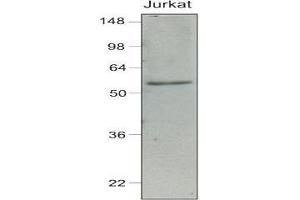 Cell lysates of Jurkat (40 ug) were resolved by SDS-PAGE, transferred to nitrocellulose membrane and probed with anti-human IRF-7 (1:1,000). (IRF7 抗体  (AA 1-150))