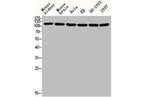 Western blot analysis of Mouse-kidney mouse-brain HELA KB SH-SY5Y 293T lysis using GCP5 antibody. (TUBGCP5 抗体  (Internal Region))
