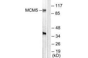 Western blot analysis of extracts from HepG2 cells, using MCM5 antibody. (MCM5 抗体)