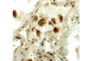 Immunohistochemical staining of human lung cells with RASSF10 polyclonal antibody  at 5 ug/mL. (RASSF10 抗体  (N-Term))