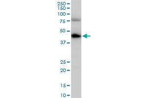 COPS3 polyclonal antibody (A01), Lot # 060113JC01. (COPS3 抗体  (AA 324-422))