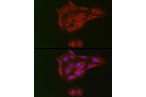 Immunofluorescence analysis of C6 cells using RTKN Rabbit pAb (ABIN6129097, ABIN6147290, ABIN6147292 and ABIN6222455) at dilution of 1:100 (40x lens). (Rhotekin 抗体  (AA 254-513))