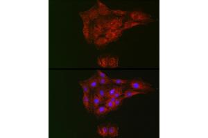 Immunofluorescence analysis of C6 cells using RTKN Rabbit pAb (ABIN6129097, ABIN6147290, ABIN6147292 and ABIN6222455) at dilution of 1:100 (40x lens). (Rhotekin 抗体  (AA 254-513))