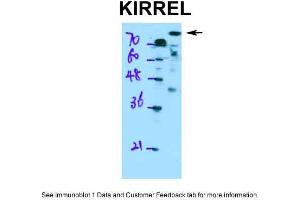 KIRREL 抗体  (Middle Region)