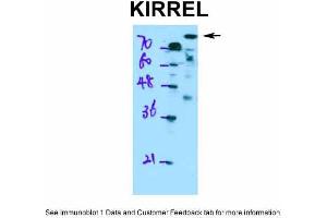 WB Suggested Anti-KIRREL Antibody Titration: 0. (KIRREL 抗体  (Middle Region))