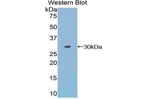 Western Blotting (WB) image for anti-Toll Interacting Protein (TOLLIP) (AA 28-261) antibody (ABIN1860826) (TOLLIP 抗体  (AA 28-261))