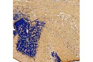 anti-Otoferlin (OTOF) antibody