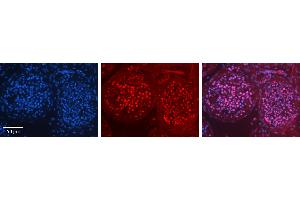 Rabbit Anti-ILF3 Antibody   Formalin Fixed Paraffin Embedded Tissue: Human Testis Tissue Observed Staining: Nucleus in spermatogonia and spermatocytes Primary Antibody Concentration: 1:100 Other Working Concentrations: 1:600 Secondary Antibody: Donkey anti-Rabbit-Cy3 Secondary Antibody Concentration: 1:200 Magnification: 20X Exposure Time: 0. (Interleukin enhancer-binding factor 3 (ILF3) (C-Term) 抗体)