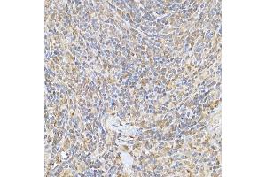 Immunohistochemistry of paraffin-embedded rat spleen using SOCS1 Rabbit pAb (ABIN6128737, ABIN6148263, ABIN6148266 and ABIN6223700) at dilution of 1:250 (40x lens). (SOCS1 抗体  (AA 1-211))