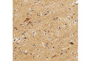 IHC analysis of DLX2 using anti-DLX2 antibody (ABIN7599936). (DLX2 抗体  (AA 13-310))