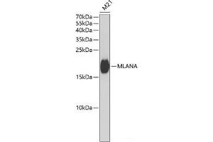 Western blot analysis of extracts of M21 cells using MLANA Polyclonal Antibody at dilution of 1:1000. (MLANA 抗体)