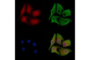ABIN6258617 and ABIN6274962 staining Hela cells by IF/ICC. (CA5B 抗体  (C-Term))