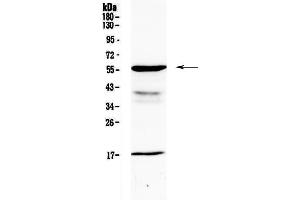 Western blot analysis of GALNS using anti-GALNS antibody . (GALNS 抗体  (AA 181-289))