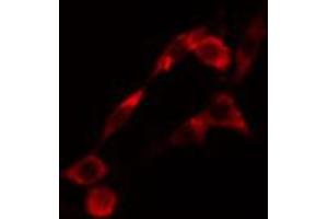 ABIN6274420 staining LOVO cells by IF/ICC. (LMTK2 抗体  (Internal Region))