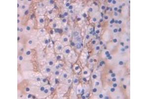 Used in DAB staining on fromalin fixed paraffin- embedded Kidney tissue (SCARB1 抗体  (AA 33-440))