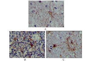 Immunohistochemical analysis of paraffin-embedded human brain tissue (A), lymphoid follicles tissue (B) and interbrain tissue (C), showing cytoplasmic localization using S100A mouse mAb with DAB staining.