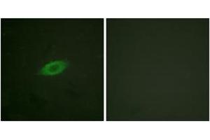 Immunofluorescence analysis of HeLa cells, using Annexin A6 Antibody. (ANXA6 抗体  (AA 1-50))