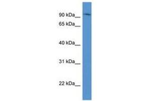 Image no. 1 for anti-ADAM Metallopeptidase Domain 8 (ADAM8) (AA 70-119) antibody (ABIN6746715) (ADAM8 抗体  (AA 70-119))
