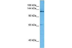 Host:  Mouse  Target Name:  CASZ1  Sample Tissue:  Mouse Pancreas  Antibody Dilution:  1ug/ml (CASZ1 抗体  (Middle Region))