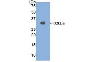 Detection of Recombinant TRAF4, Human using Polyclonal Antibody to TNF Receptor Associated Factor 4 (TRAF4) (TRAF4 抗体  (AA 193-444))