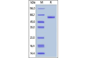 Biotinylated Human TNFSF11, Avitag,Fc Tag on  under reducing (R) condition. (RANKL Protein (AA 64-245) (AVI tag,Fc Tag,Biotin))
