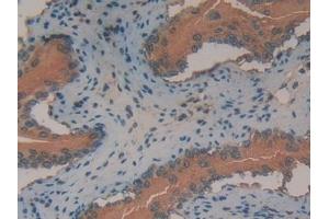 Detection of ANXA2 in Mouse Vas Deferens Tissue using Polyclonal Antibody to Annexin A2 (ANXA2) (Annexin A2 抗体  (AA 1-339))