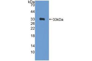 Western blot analysis of recombinant Rat GATA4. (GATA4 抗体  (AA 228-440))