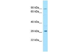 Host:  Rabbit  Target Name:  Foxk1  Sample Type:  Rat Thymus lysates  Antibody Dilution:  1. (Foxk1 抗体  (N-Term))