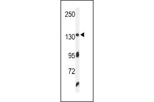 Western blot analysis of ZO1 Antibody (C-term) (ABIN650980 and ABIN2840020) in K562 cell line lysates (35 μg/lane). (TJP1 抗体  (C-Term))