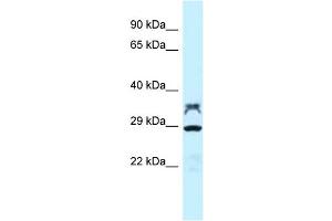WB Suggested Anti-LOC100362453 Antibody Titration: 1. (LOC100362453 抗体  (C-Term))