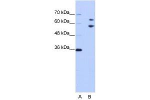 TROVE2 antibody used at 1 ug/ml to detect target protein. (TROVE2 抗体  (N-Term))